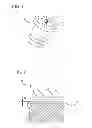 Fig. 02 - Intradermal delivery device