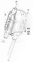 Fig. 04 - Differential pressure based flow sensor assembly for medication delivery monitoring and method of using the same