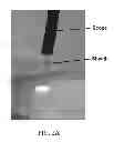 Fig. 03 - Protective sheath and method of using same for laser surgery