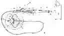 Fig. 01 - COMPLIANT BALLOON CATHETER