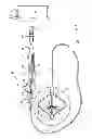 Fig. 02 - COMPLIANT BALLOON CATHETER