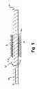 Fig. 08 - Thermal surgical tool