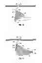 Fig. 07 - Specimen retrieval apparatus