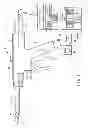 Fig. 02 - Ultrasonic treatment device