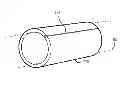 Fig. 01 - Method for deploying a sleeve and tubing device for restricting and constricting aneurysms and a sleeve and tubing device and system
