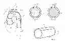 Fig. 02 - Method for deploying a sleeve and tubing device for restricting and constricting aneurysms and a sleeve and tubing device and system