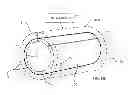 Fig. 06 - Method for deploying a sleeve and tubing device for restricting and constricting aneurysms and a sleeve and tubing device and system