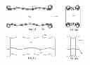 Fig. 08 - Method for deploying a sleeve and tubing device for restricting and constricting aneurysms and a sleeve and tubing device and system