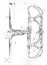 Fig. 02 - Left atrial appendage occlusion device