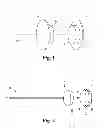 Fig. 02 - Methods and systems for treating complex fistulae