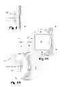 Fig. 04 - Methods and systems for treating complex fistulae