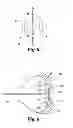 Fig. 06 - Methods and systems for treating complex fistulae