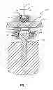 Fig. 02 - DYNAMIC MULTI-AXIAL ANCHOR