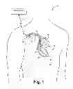 Fig. 02 - Criteria for optimal electrical resynchronization derived from multipolar leads or multiple electrodes during biventricular pacing
