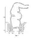Fig. 02 - System and method for electrical stimulation of anorectal structures to treat anal dysfunction