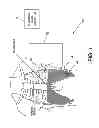 Fig. 02 - System and method for conditioning a diaphragm of a patient