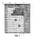 Fig. 06 - Cochlear implant fitting system