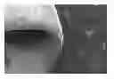 Fig. 01 - Scaffold system for tissue repair