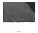 Fig. 09 - Scaffold system for tissue repair