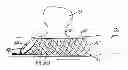 Fig. 01 - MEDICAL DEVICE AND SYSTEM HAVING SUCH A DEVICE