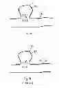 Fig. 02 - MEDICAL DEVICE AND SYSTEM HAVING SUCH A DEVICE