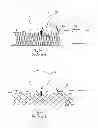 Fig. 06 - MEDICAL DEVICE AND SYSTEM HAVING SUCH A DEVICE