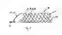 Fig. 08 - MEDICAL DEVICE AND SYSTEM HAVING SUCH A DEVICE