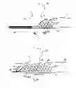 Fig. 09 - MEDICAL DEVICE AND SYSTEM HAVING SUCH A DEVICE