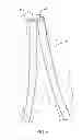 Fig. 07 - Abdominal aortic stent
