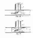 Fig. 07 - APPARATUS AND METHOD FOR CONNECTING A CONDUIT TO A HOLLOW VESSEL