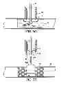 Fig. 08 - APPARATUS AND METHOD FOR CONNECTING A CONDUIT TO A HOLLOW VESSEL
