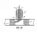 Fig. 12 - APPARATUS AND METHOD FOR CONNECTING A CONDUIT TO A HOLLOW VESSEL