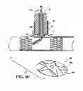 Fig. 13 - APPARATUS AND METHOD FOR CONNECTING A CONDUIT TO A HOLLOW VESSEL