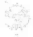 Fig. 45 - Collapsible prosthetic heart valves