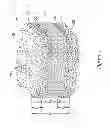 Fig. 02 - Composite implant