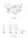 Fig. 02 - Systems and methods for providing an asymmetrical tibial component