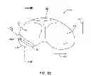 Fig. 09 - Systems and methods for providing an asymmetrical tibial component