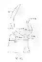 Fig. 35 - Systems and methods for providing an asymmetrical tibial component