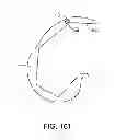 Fig. 43 - Systems and methods for providing an asymmetrical tibial component