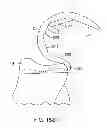 Fig. 49 - Systems and methods for providing an asymmetrical tibial component