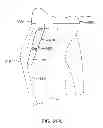 Fig. 72 - Systems and methods for providing an asymmetrical tibial component