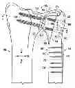 Fig. 01 - PARTIAL OR COMPLETE PROSTHETIC REPLACEMENT ARTHROPLASTY OF THE DISTAL RADIOLULNAR JOINT