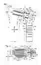 Fig. 02 - PARTIAL OR COMPLETE PROSTHETIC REPLACEMENT ARTHROPLASTY OF THE DISTAL RADIOLULNAR JOINT