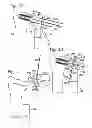 Fig. 07 - PARTIAL OR COMPLETE PROSTHETIC REPLACEMENT ARTHROPLASTY OF THE DISTAL RADIOLULNAR JOINT