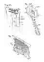 Fig. 08 - PARTIAL OR COMPLETE PROSTHETIC REPLACEMENT ARTHROPLASTY OF THE DISTAL RADIOLULNAR JOINT