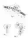 Fig. 02 - Artificial joint