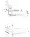Fig. 02 - Revision hip prosthesis having an implantable distal stem component