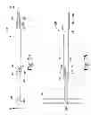 Fig. 09 - Revision hip prosthesis having an implantable distal stem component