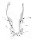 Fig. 01 - ADJUSTABLE PROSTHETIC SOCKET AND SUSPENSION SYSTEM
