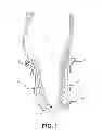 Fig. 02 - ADJUSTABLE PROSTHETIC SOCKET AND SUSPENSION SYSTEM